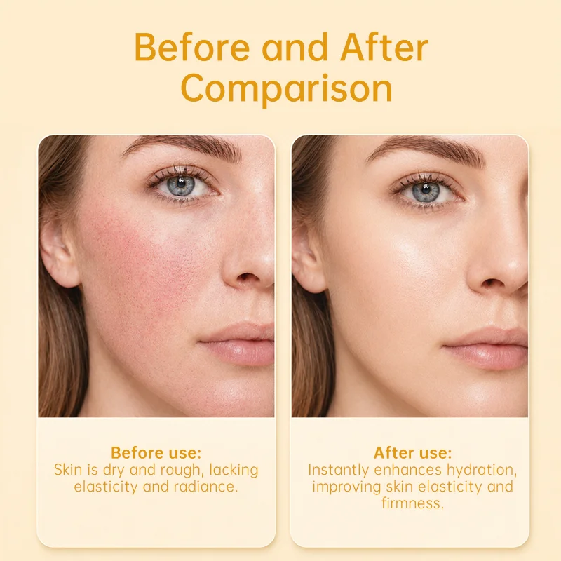 Side-by-side comparison of a woman's face showing dry skin on the left and hydrated, glowing skin on the right, with text explanations.